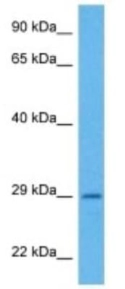 PEMT Rabbit anti-Mouse, Polyclonal, Novus Biologicals 25 &mu;g; Unconjugated:Antibodies,